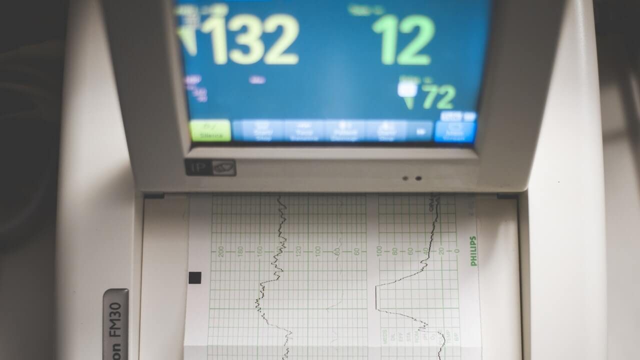 close-up-of-ecg-machine